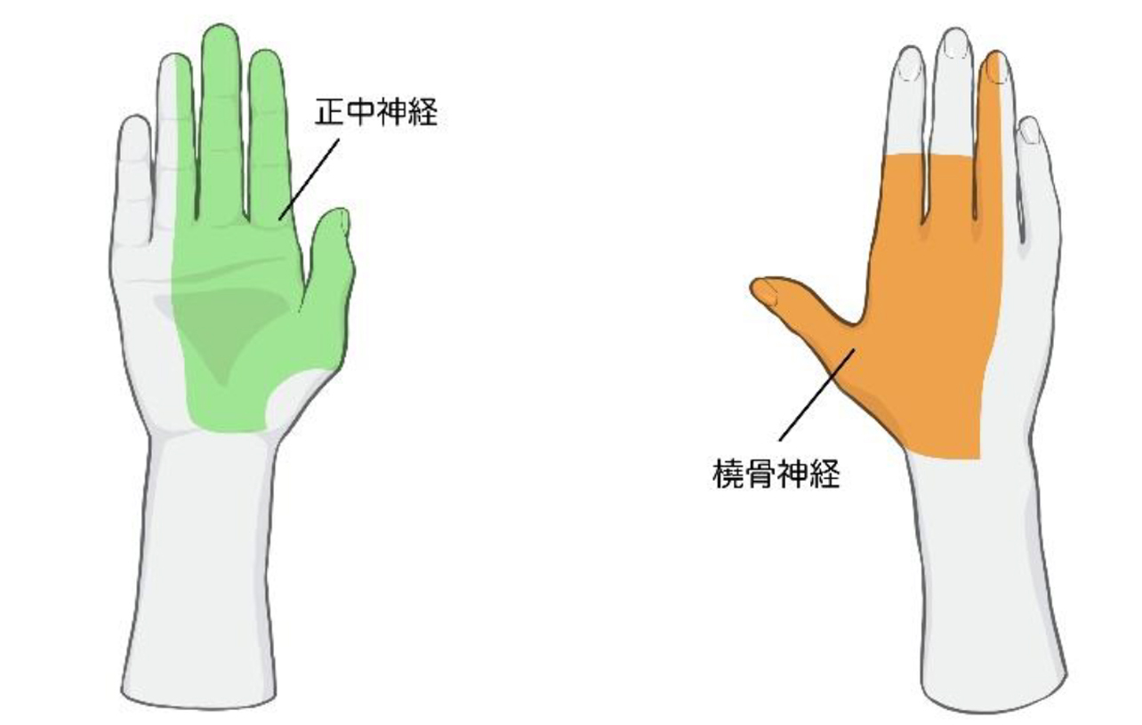 胸郭出口症候群