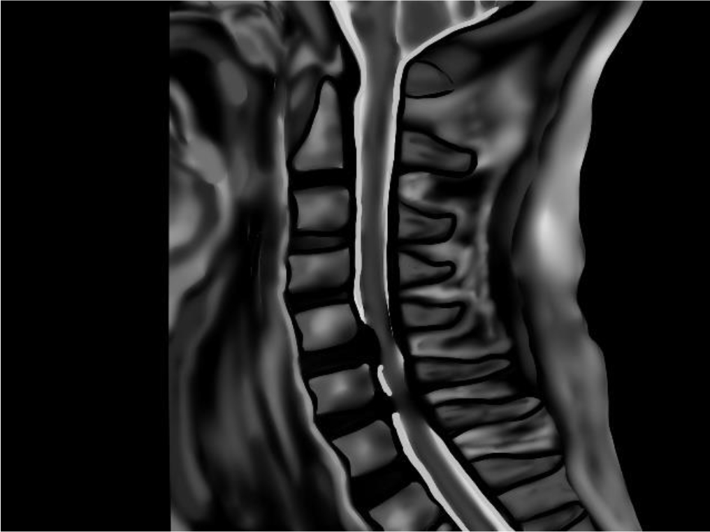 首の痛みを伴う疾患病気や症状